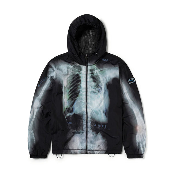 + Aries X-Ray Windcheater Jacket 'Black'